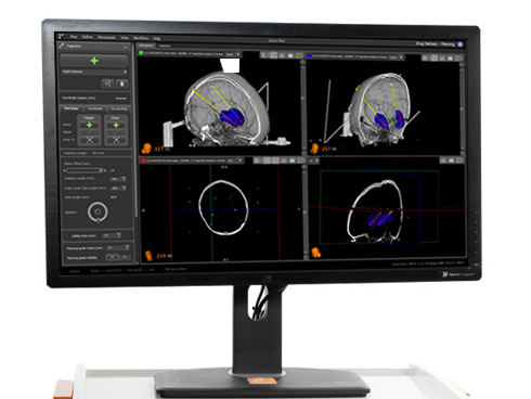 Planning station neuroinspire thumbnail