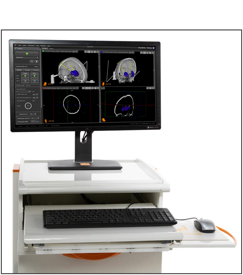 neuroinspire™ planning software