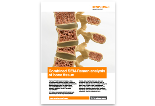 AN265(EN)-00-I_Combined SEM-Raman analysis of bone tissue