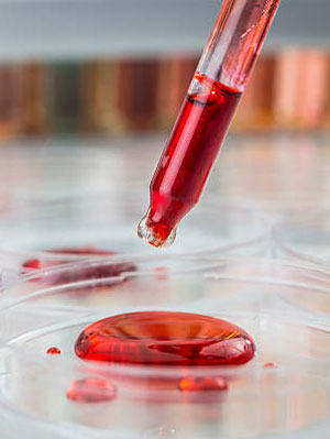 Blood sample