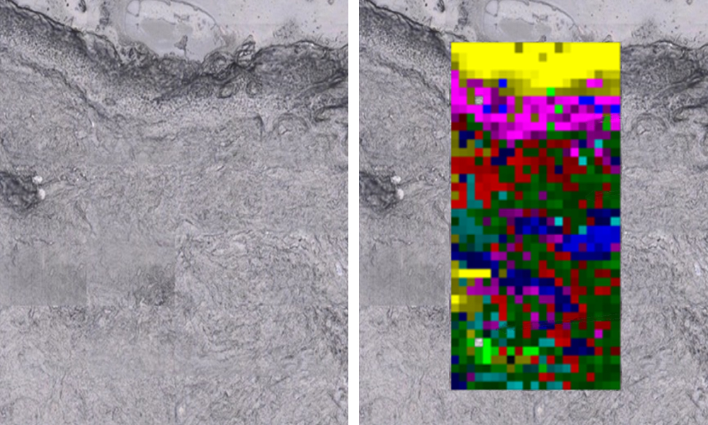 Transdermal Raman-bild