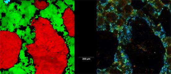 Fluorescence Lifetime Imaging Microscopy